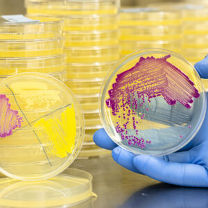 A person wearing blue gloves is holding a petri dish with colorful bacterial cultures. There are stacks of similar petri dishes in the background.