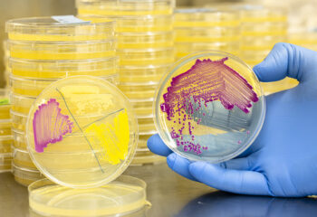 A person wearing blue gloves is holding a petri dish with colorful bacterial cultures. There are stacks of similar petri dishes in the background.
