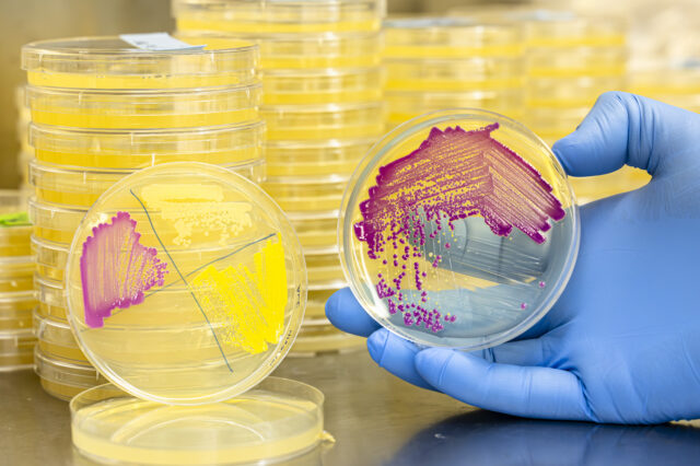 A person wearing blue gloves is holding a petri dish with colorful bacterial cultures. There are stacks of similar petri dishes in the background.